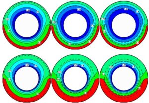 Thermoelastic response of multilayer inhomogeneous cylinders: direct integration and single-material approach.